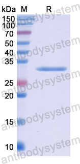 Recombinant Human ANP32B Protein, N-His