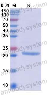 Recombinant Human PTPRU Protein, N-His