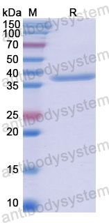 Recombinant Human ESR2 Protein, N-His