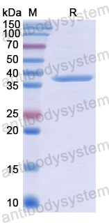 Recombinant Human USP6NL Protein, N-His