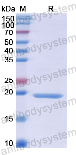 Recombinant Human HTRA1 Protein, N-His