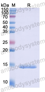 Recombinant Human HDAC2 Protein, N-His