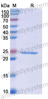 Recombinant Human STAM Protein, N-His