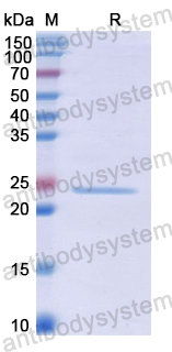 Recombinant Human PROX1 Protein, N-His