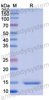 Recombinant Human HAS2 Protein, N-His