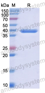 Recombinant Human PCSK5 Protein, N-His