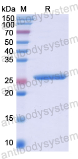 Recombinant Human TANK Protein, N-His