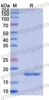 Recombinant Human CD100/SEMA4D Protein, N-His