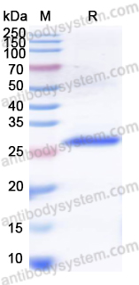 Recombinant Human KLK6 Protein, N-His