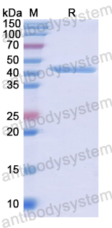 Recombinant Human RAD50 Protein, N-His