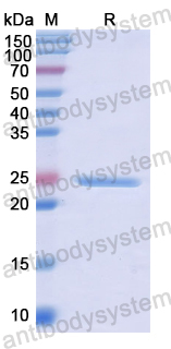 Recombinant Human OSTF1 Protein, N-His