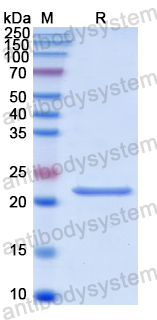 Recombinant Human PTPRN2 Protein, N-His
