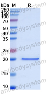 Recombinant Human BAD Protein, N-His