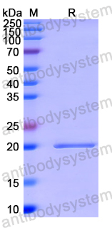 Recombinant Human GCDH Protein, N-His