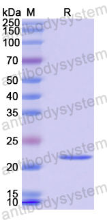 Recombinant Human DVL3 Protein, N-His-SUMO