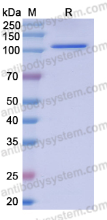 Recombinant Human USP7 Protein, N-His