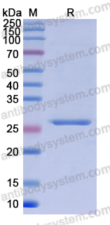 Recombinant Human CD101 Protein, N-His