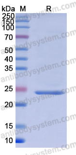 Recombinant Human HGD Protein, N-His
