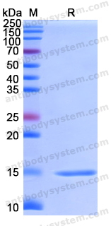 Recombinant Human KISS1R Protein, N-His