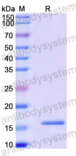 Recombinant Human KISS1R Protein, N-His-SUMO
