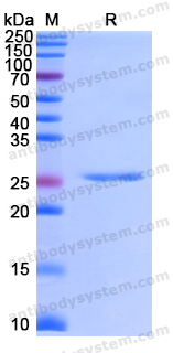 Recombinant Human FBXO32 Protein, N-His