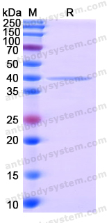 Recombinant Human HDAC10 Protein, N-His
