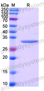 Recombinant Human ST6GALNAC6/Sialyltransferase 7F Protein, N-His