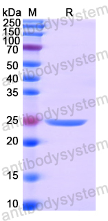 Recombinant Human FUBP1 Protein, N-His