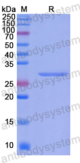 Recombinant Human CIDEC Protein, N-His