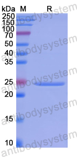 Recombinant Human RAB37 Protein, N-His