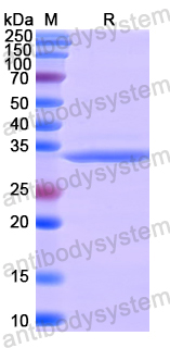 Recombinant Human FKBP10 Protein, N-His