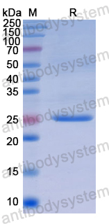 Recombinant Human CTHRC1 Protein, N-His