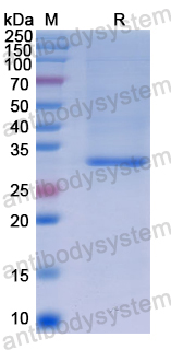 Recombinant Human CD365/KIM-1/TIM-1/HAVCR1 Protein, N-His