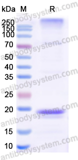 Recombinant Human ZG16B Protein, N-His