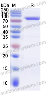 Recombinant Human SIRT1 Protein, N-His