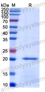 Recombinant Human CD217/IL17RA Protein, N-His