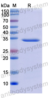 Recombinant Human NEIL1 Protein, N-His