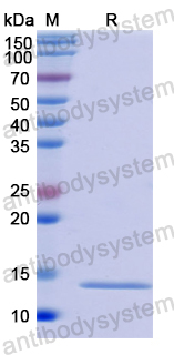 Recombinant Human S100A16 Protein, N-His