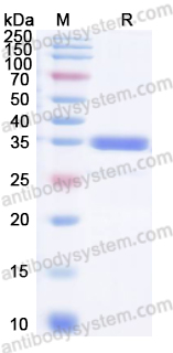Recombinant Human OTUB1 Protein, N-His