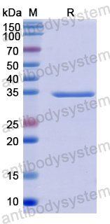 Recombinant Human KAZALD1 Protein, N-His