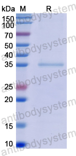 Recombinant Human CPB2 Protein, N-His