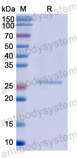 Recombinant Human EPSTI1 Protein, N-His