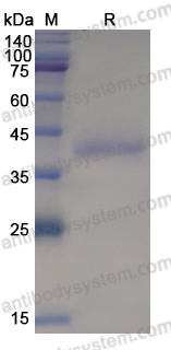 Recombinant Human LRIG1 Protein, N-His