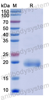 Recombinant Human LOXL4 Protein, N-His