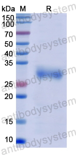 Recombinant Human WDR90 Protein, N-His