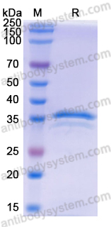 Recombinant Human NECTIN4/PVRL4 Protein, N-His