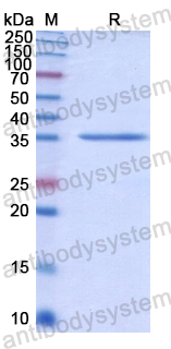 Recombinant Human GBP4 Protein, N-His