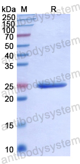 Recombinant Human SIGLEC12 Protein, N-His
