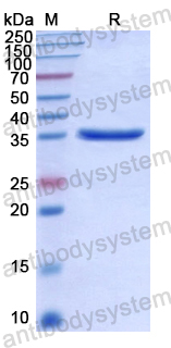 Recombinant Human LMTK3 Protein, N-His