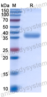 Recombinant Human UCN2 Protein, N-GST
